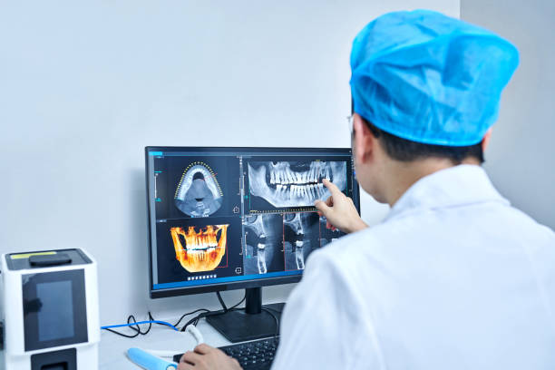 Best Knocked-Out Tooth (Avulsed Tooth) Treatment in Terry, MS