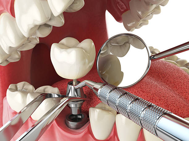 Best Emergency Cosmetic Dentistry (e.g., broken veneers) in Terry, MS